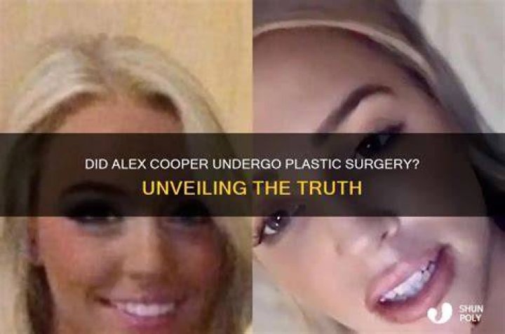 Alex Cooper Denied Plastic Surgery Rumors