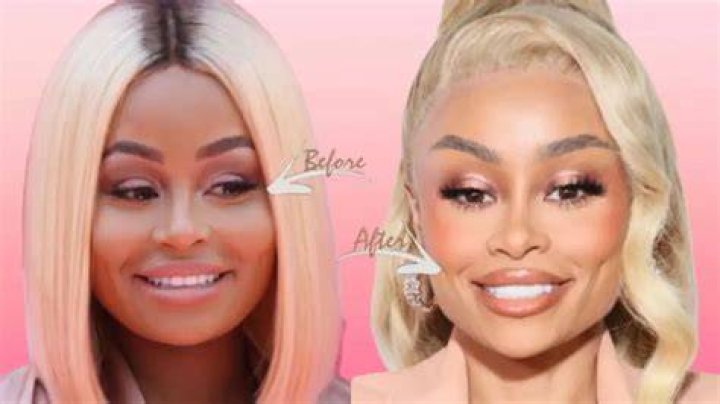 Blac Chyna’s Before And After Transformation: Explained