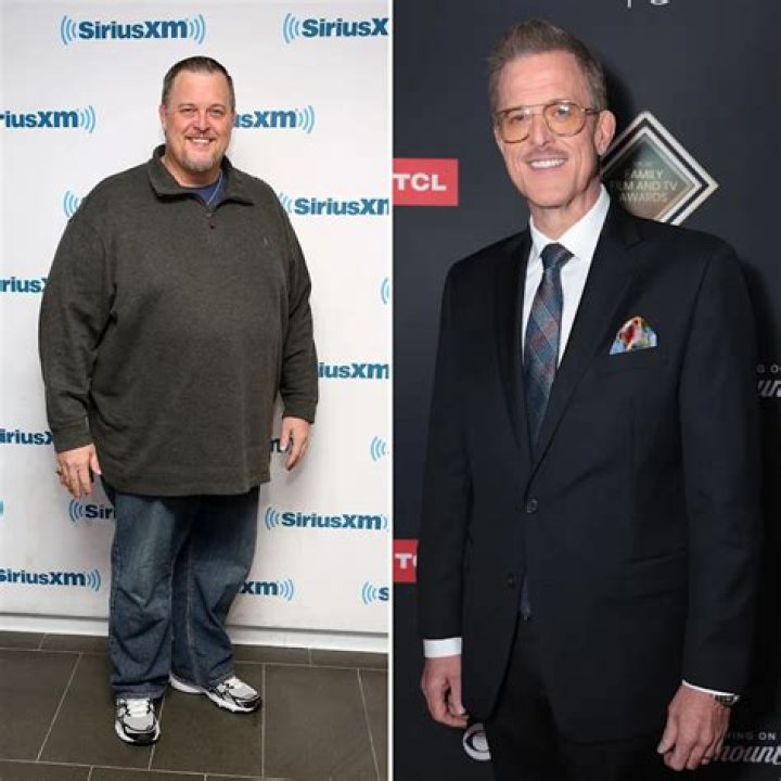 Did Billy Gardell Have Weight Loss Surgery- How Much Weight Did He Lose?