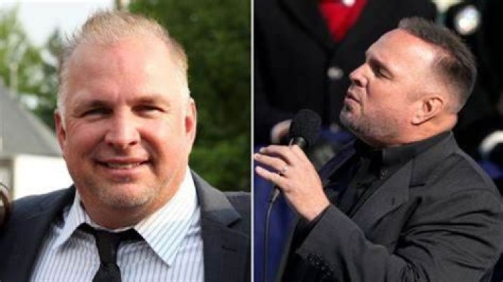 Did Garth Brooks Have Plastic Surgery? Hair Plugs and Facelift Concerns Addressed