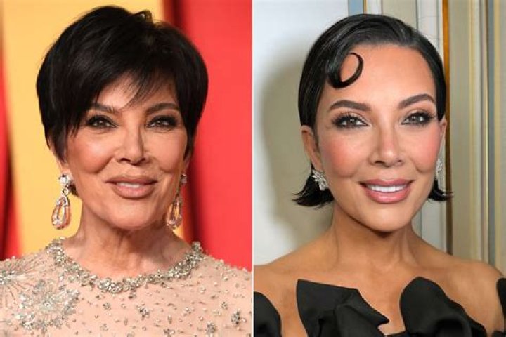 
Did Herlene Nicole Budol Have A Nose Rhinoplasty Surgery? Details About Her Plastic Surgery 