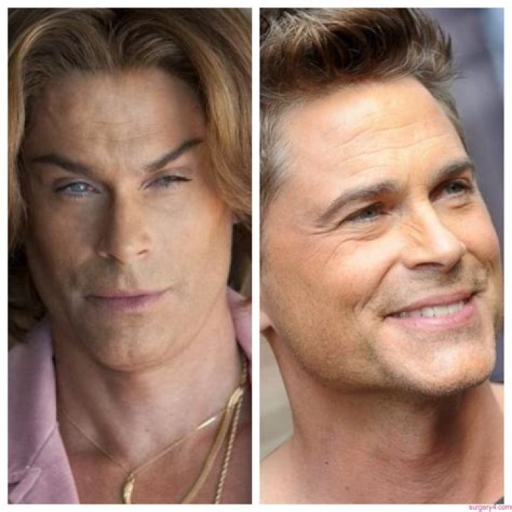 Did Rob Lowe Get Plastic Surgery On His Face? Here’s the Truth!