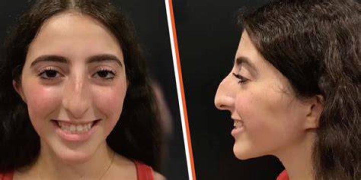 Did Yasmin Vossoughian Suffer A Stroke? MSNBC Host Face And Mouth Condition Explained