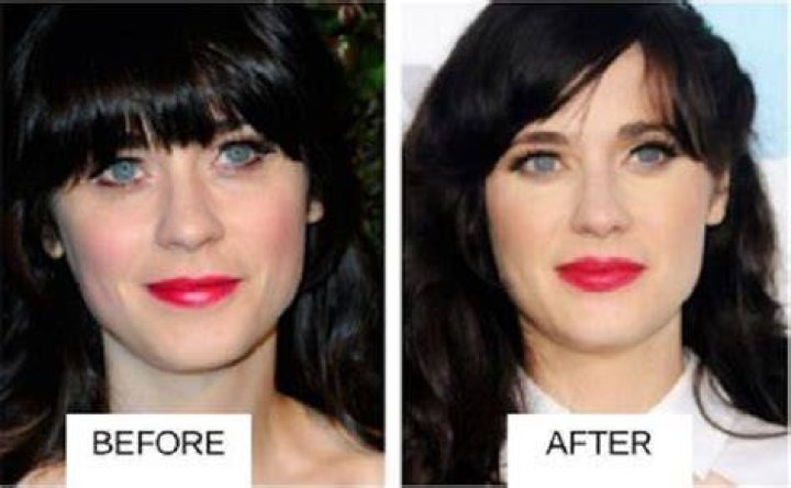
Did Zooey Deschanel Get A Plastic Surgery? Facts Behind The Rumors 
