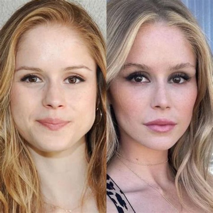 Does Erin Moriarty Have Eating Disorder? Illness And health Update, Plastic Surgery Before And After