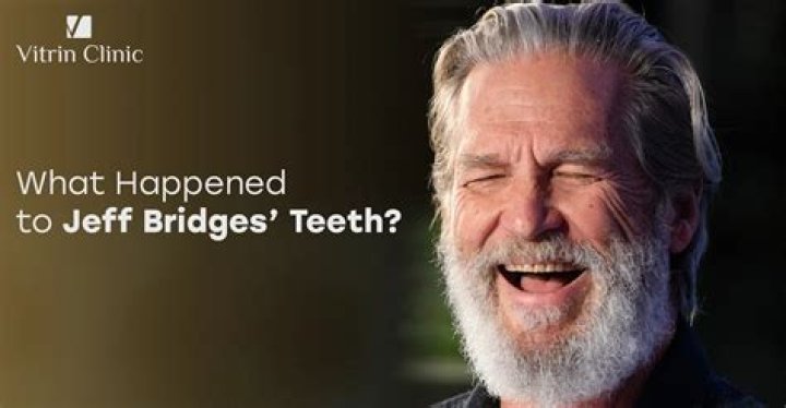 
Does Jeff Bridges Have Teeth Problem? Illness And Health Update 