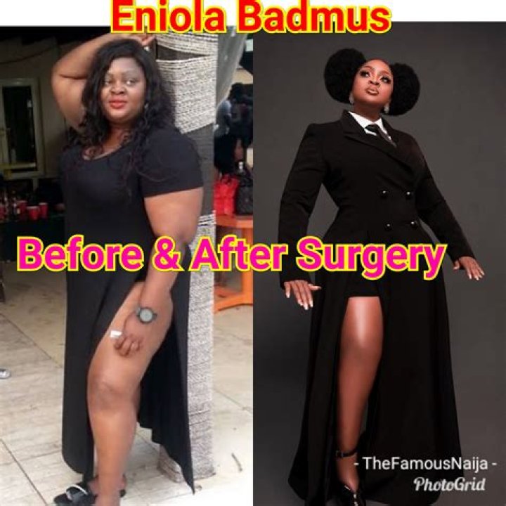 
Eniola Badmus Sickness And Health: Weight Loss Before And After Photos 
