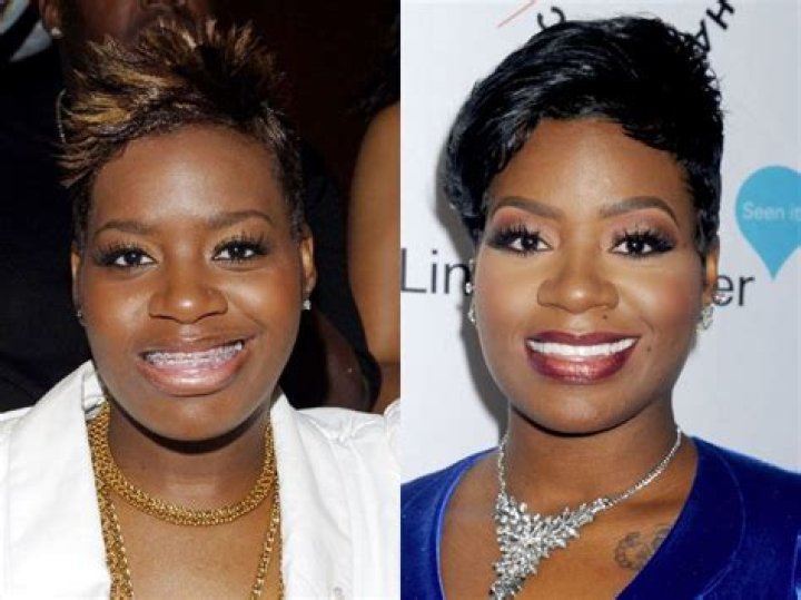 
Fantasia Barrino Plastic Surgery Before and After, Who is Fantasia Barrino? 