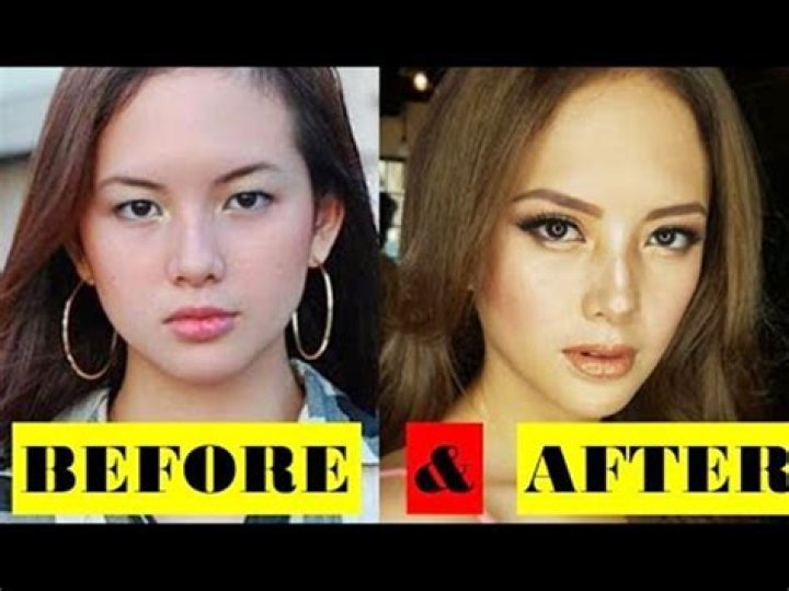 
Filipino Actress Ellen Adarna Plastic Surgery | Before And After Photos 