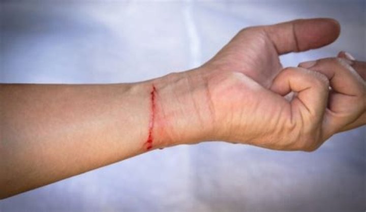 Hand Dryer Blade Tiktok Video Explained- Blood & Hand Cut Off- What Happened?