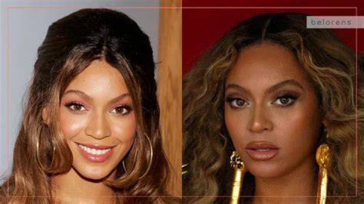 Has Beyonce Had A Nose Job or Plastic Surgery?