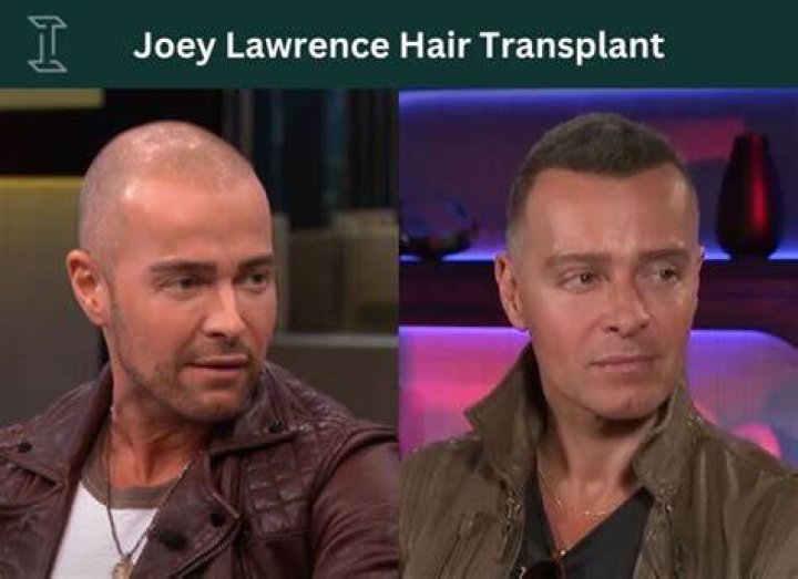 Has Joey Lawrence Had Hair Transplant? His Bald Phase and Plastic Surgery Rumors Debunked