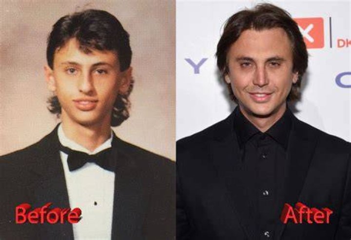 Has Jonathan Cheban Had Plastic Surgery?