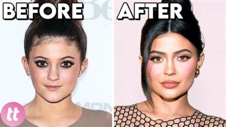 Health Update: Has Hayley Williams Done Plastic Surgery? Before And After Photo
