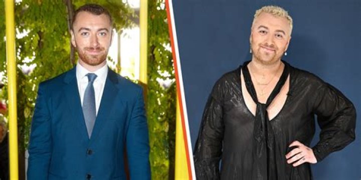 
How Long Is Sam Smith Hair Now? Did He Cut it? Illness And Surgery Update 
