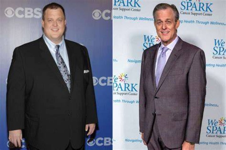 Is Billy Gardell Sick? Did He Undergo Bariatric Surgery? Details To Know