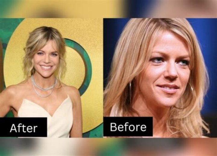 Kaitlin Olson Plastic Surgery As Dee From Always Sunny