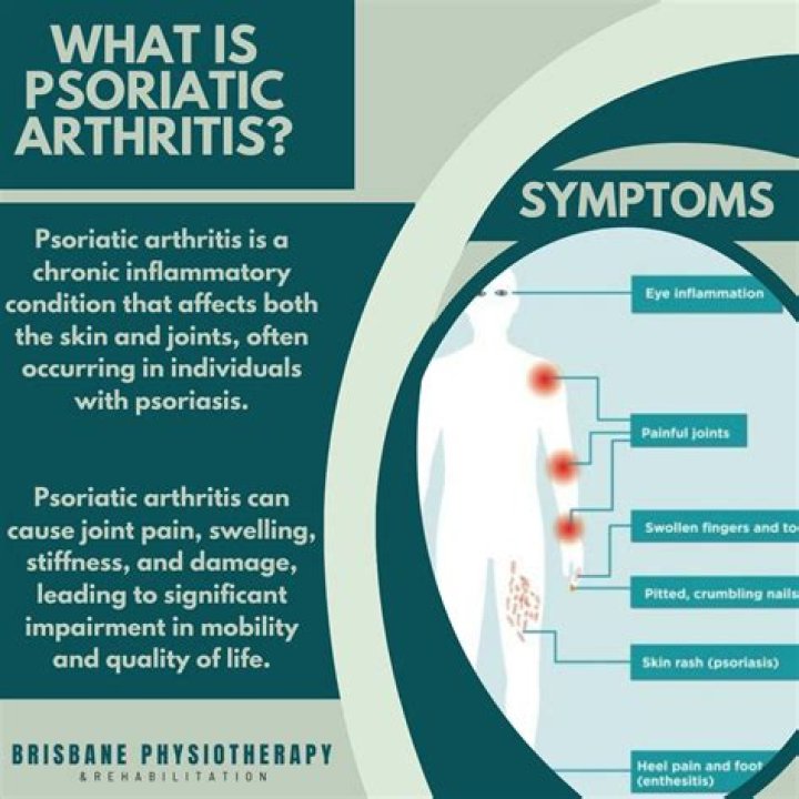 
Lance Bass Illness And Health Issues Explained- What Is Psoriatic Arthritis? 