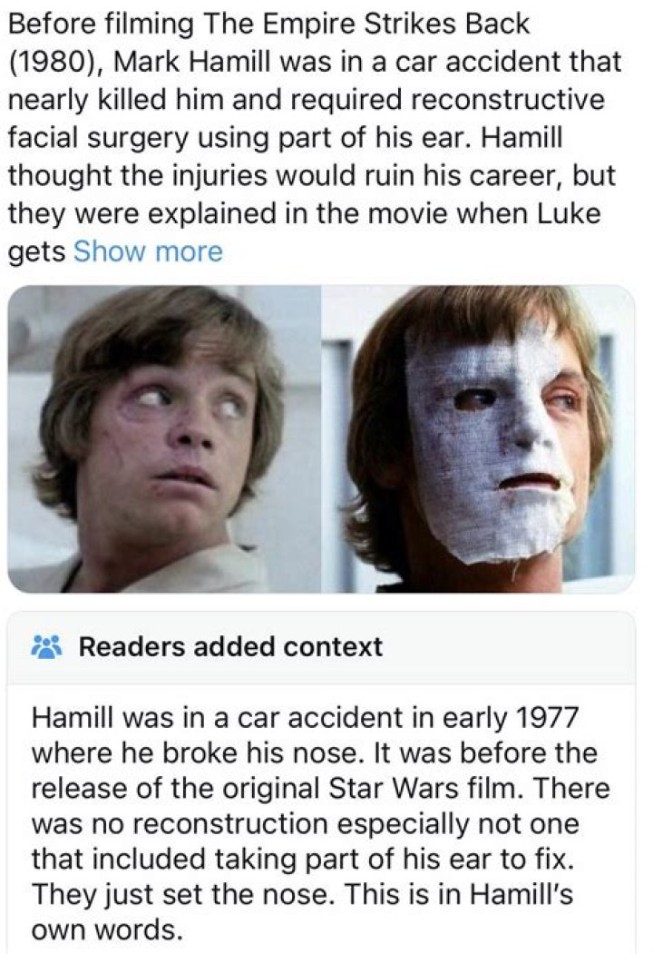 
Mark Hamill Face Scars And Accident Update: What Happened To Him? 