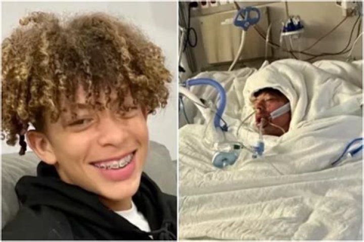 Mason Dark GoFundMe raises more than $18,000 after TikTok challenge leaves Wake Forest teen with 80% burns