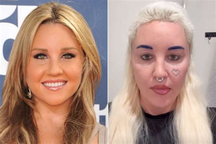 Michelle Dee No Makeup Look: Plastic Surgery Before And After