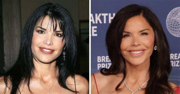 
Monica Aldama Plastic Surgery Before And After Photos Explored 