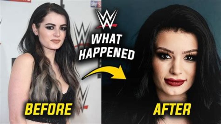 
Paige Weight Loss: Saraya-Jade Bevis Before And After Photos 
