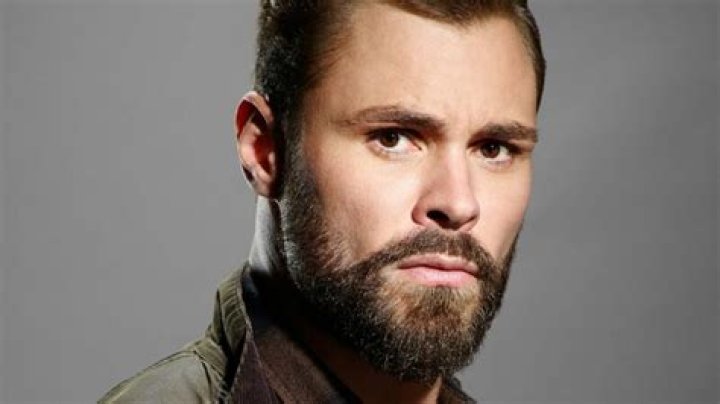 Patrick Flueger Face and Plastic Surgery Concerns Addressed