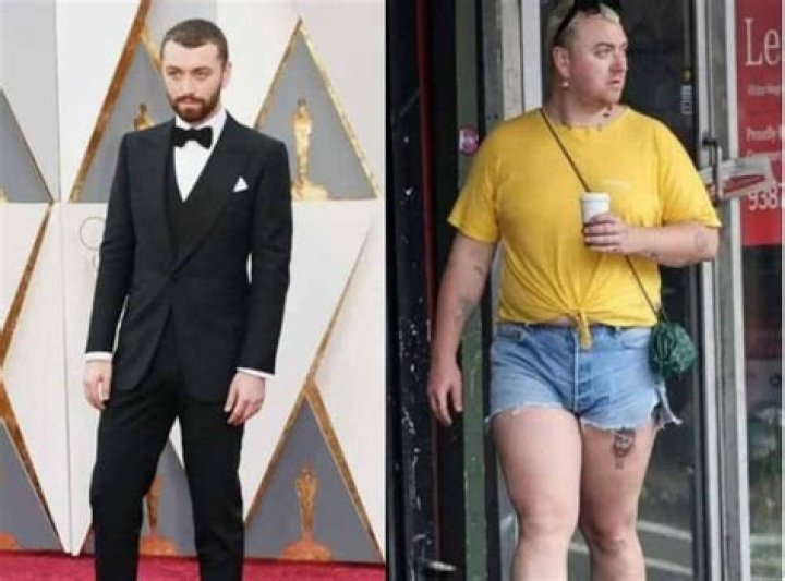 
Sam Smith Before And After: Secret Revealed! 