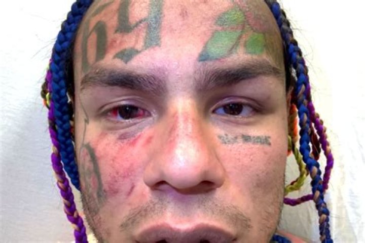 
Tekashi 6ix9ine and Lenier drop ‘Bori’: Shot in Cuba, music video features rapper receiving treatment after gym attack 