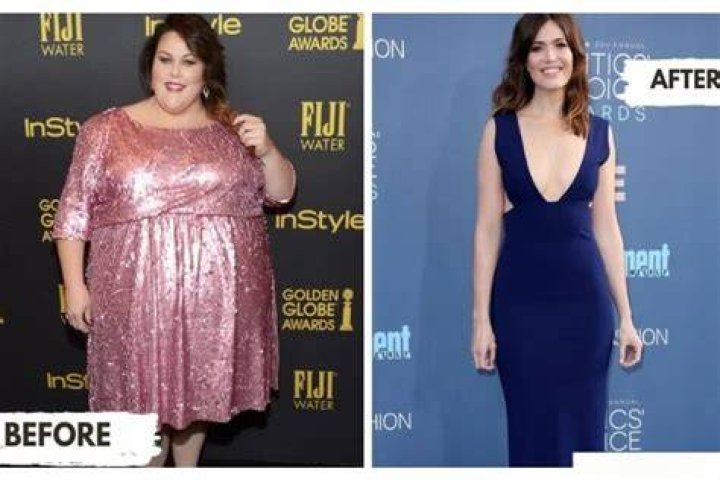 
What Did Faye Winter Look Before Surgery? Here Are Before And After Pictures Of Her Weight Loss And Plastic Surgery Transformation 