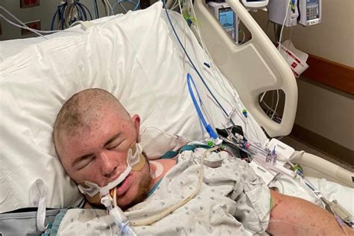 
What Happened To Austin Bellamy? Austin Bellamy: An Ohio Guy Who Was Stung 20,000 Times By Bees Has Been Brought Out Of A Coma 