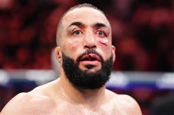 
What Happened To Belal Muhammad Eye? Details On His Face Injury And Update Today 