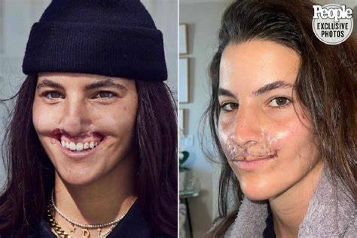 What Happened To Brooke Khoury?