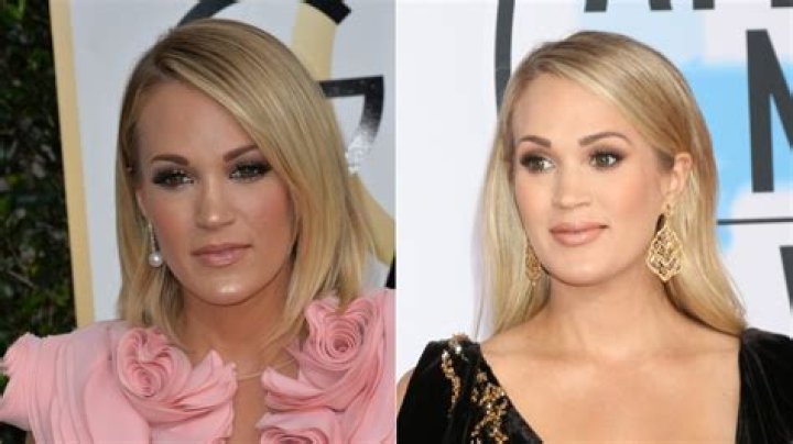 What Happened to Carrie Underwood’s Face? Who is Carrie Underwood? Carrie Underwood’s Age, Net Worth, and More
