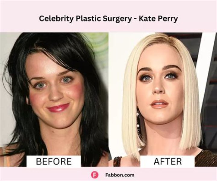 What Is Ekin Su Real Name? Here Are Her Before And After Plastic Surgery Pictures