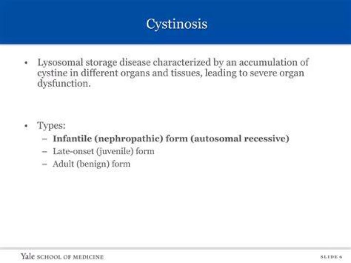 What Is Willow Pill Illness? Cystinosis Disease and Health Update 2022