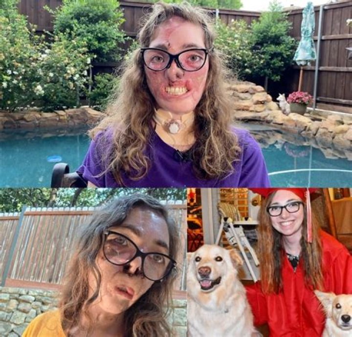 Where Is Jacqueline Durand In 2022? Dr Justin Bishop Dog Attack Victim Today