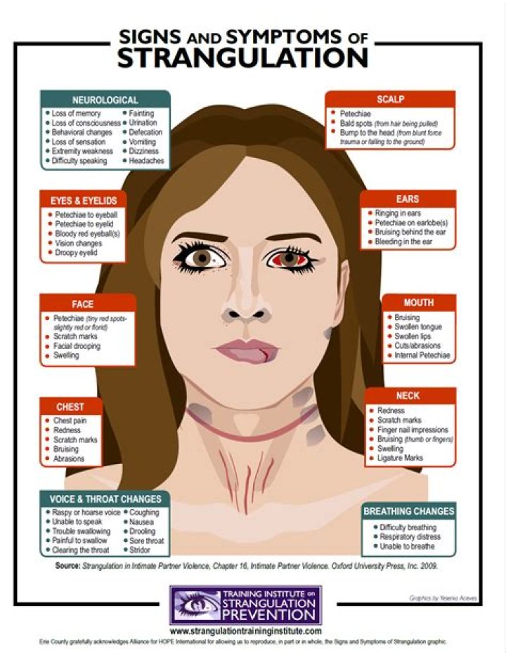 
Who Did Rod Wave Choke? Strangulation Charges And Victim Details, What Exactly Happened? 