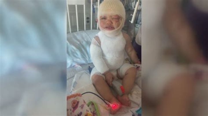 
Who Is Dominick Krankall? 6 Year Old Burned By Bully, Update Now 