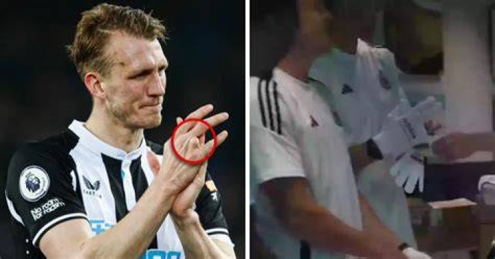 
Why Is Dan Burn Missing a Finger? Heres What Happened To The Premier League Footballer 