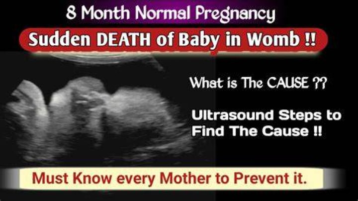 
Woman, 8 Months Pregnant, Dies After Couple Cuts Unborn Baby from Womb, Pretends Infant Is Theirs: Authorities 