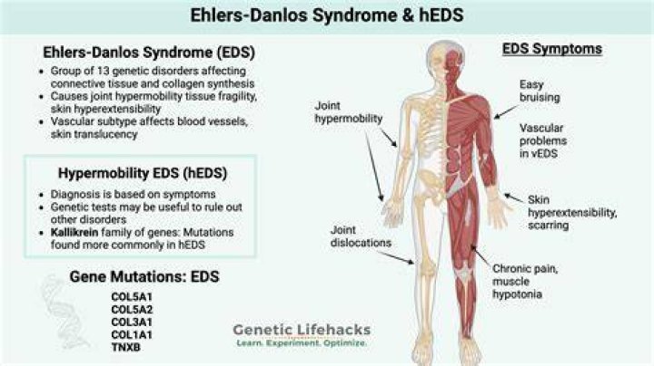 
Yvie Oddly Has Ehlers–Danlos Syndrome Type 3: More On The Drag Queen Illness And Health Update 2022 